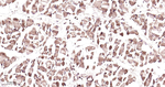 PSMA2 Recombinant Rabbit Monoclonal Antibody (2H5)
