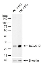 BCL2L12 Recombinant Rabbit Monoclonal Antibody (9D4)