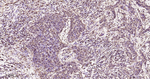 ALY Antibody in Immunohistochemistry (Paraffin) (IHC (P))
