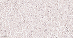 ALY Antibody in Immunohistochemistry (Paraffin) (IHC (P))