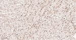 ALY Antibody in Immunohistochemistry (Paraffin) (IHC (P))