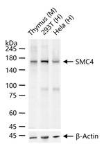 SMC4 Recombinant Rabbit Monoclonal Antibody (6C1)