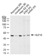 KLF10 Recombinant Rabbit Monoclonal Antibody (7C12)