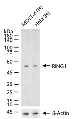 RING1 Recombinant Rabbit Monoclonal Antibody (12D3)
