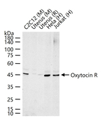 Oxytocin Receptor Recombinant Rabbit Monoclonal Antibody (12B12)