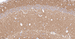 GluR1 Recombinant Rabbit Monoclonal Antibody (5H8)