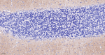 GluR1 Antibody in Immunohistochemistry (Paraffin) (IHC (P))