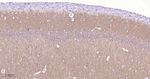 GluR1 Antibody in Immunohistochemistry (Paraffin) (IHC (P))