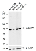 SLC22A1 Recombinant Rabbit Monoclonal Antibody (8G2)