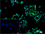 ANP32B Recombinant Rabbit Monoclonal Antibody (3G10)