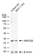 ANP32B Antibody in Western Blot (WB)