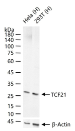 TCF21 Recombinant Rabbit Monoclonal Antibody (9G4)