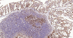 G3BP1 Antibody in Immunohistochemistry (Paraffin) (IHC (P))