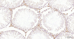 G3BP1 Antibody in Immunohistochemistry (Paraffin) (IHC (P))