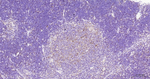 G3BP1 Antibody in Immunohistochemistry (Paraffin) (IHC (P))