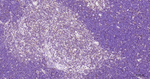 G3BP1 Antibody in Immunohistochemistry (Paraffin) (IHC (P))