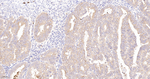 G3BP1 Antibody in Immunohistochemistry (Paraffin) (IHC (P))