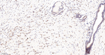 G3BP1 Antibody in Immunohistochemistry (Paraffin) (IHC (P))