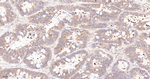 G3BP1 Antibody in Immunohistochemistry (Paraffin) (IHC (P))
