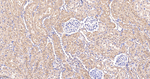 G3BP1 Antibody in Immunohistochemistry (Paraffin) (IHC (P))