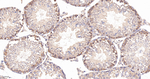 G3BP1 Antibody in Immunohistochemistry (Paraffin) (IHC (P))