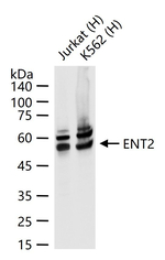 ENT2 Recombinant Rabbit Monoclonal Antibody (9E15)