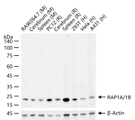 RAP1A/RAP1B Recombinant Rabbit Monoclonal Antibody (5A1)
