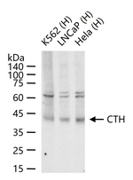 CTH Recombinant Rabbit Monoclonal Antibody (14F4)