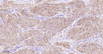 MYL9 Antibody in Immunohistochemistry (Paraffin) (IHC (P))