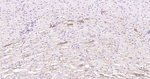 PAR2 Antibody in Immunohistochemistry (Paraffin) (IHC (P))
