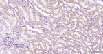 PAR2 Antibody in Immunohistochemistry (Paraffin) (IHC (P))