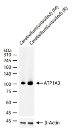 ATP1A3 Recombinant Rabbit Monoclonal Antibody (3D11)