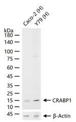 CRABP1 Antibody in Western Blot (WB)