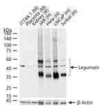 LGMN Recombinant Rabbit Monoclonal Antibody (12C11)