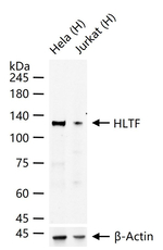 HLTF Recombinant Rabbit Monoclonal Antibody (7G3)