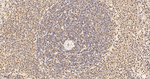 UAP56 Antibody in Immunohistochemistry (Paraffin) (IHC (P))