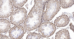 UAP56 Antibody in Immunohistochemistry (Paraffin) (IHC (P))