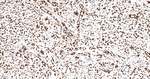UAP56 Antibody in Immunohistochemistry (Paraffin) (IHC (P))