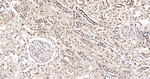 UAP56 Antibody in Immunohistochemistry (Paraffin) (IHC (P))