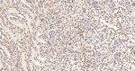 UAP56 Antibody in Immunohistochemistry (Paraffin) (IHC (P))