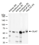 DLAT Recombinant Rabbit Monoclonal Antibody (8C4)