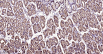 IDH1 Antibody in Immunohistochemistry (Paraffin) (IHC (P))