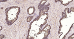 IDH1 Recombinant Rabbit Monoclonal Antibody (20C14)