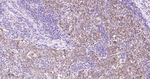 IDH1 Antibody in Immunohistochemistry (Paraffin) (IHC (P))