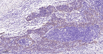 IDH1 Antibody in Immunohistochemistry (Paraffin) (IHC (P))