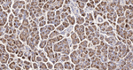 Carboxypeptidase A1/A2/B Recombinant Rabbit Monoclonal Antibody (11A12)