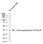 Carboxypeptidase A1/A2/B Antibody in Western Blot (WB)