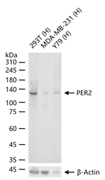 PER2 Recombinant Rabbit Monoclonal Antibody (1A11)