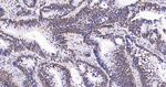 Pokemon Antibody in Immunohistochemistry (Paraffin) (IHC (P))