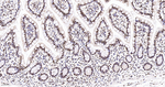 Pokemon Antibody in Immunohistochemistry (Paraffin) (IHC (P))